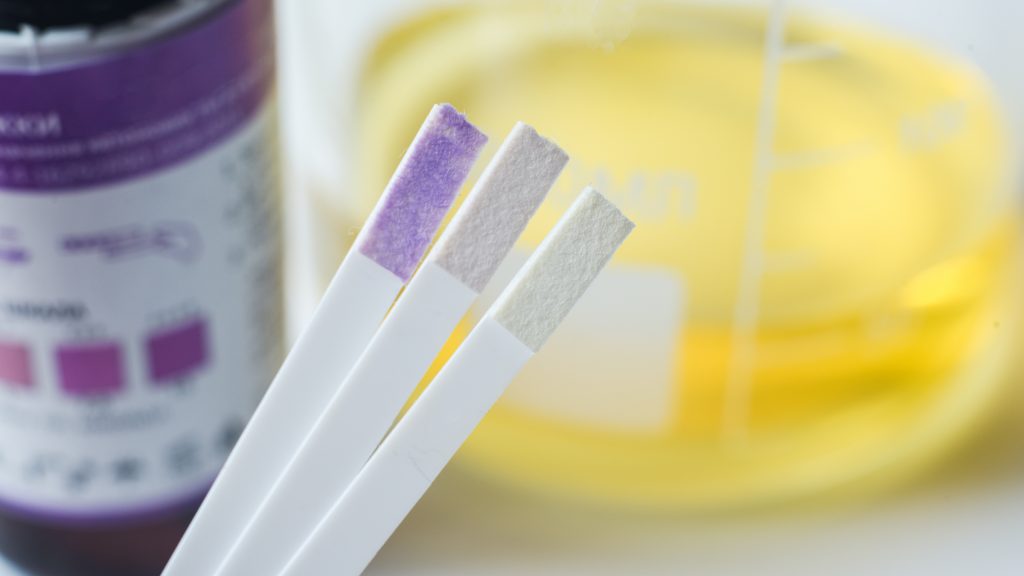 Urine Drug Tests